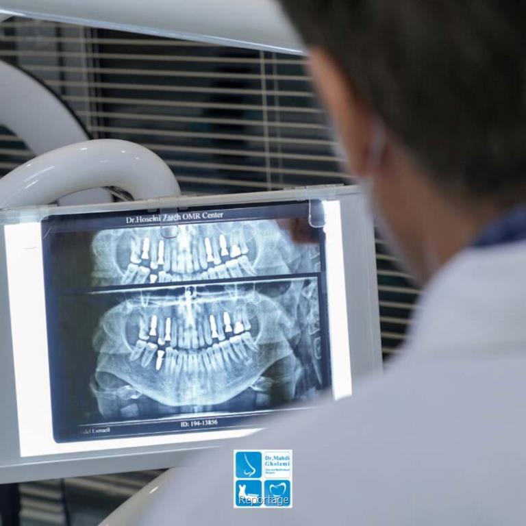 جراحی بینی و جراحی ایمپلنت در مشهد